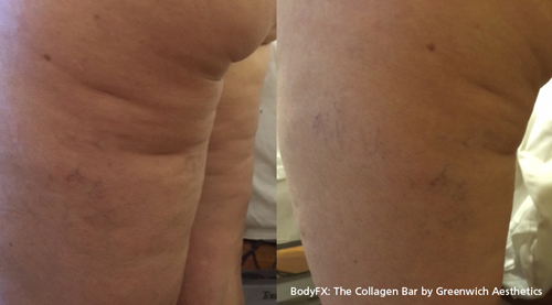 BodyFX Before & After