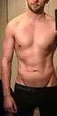 Abdomen Before & After Patient #5875