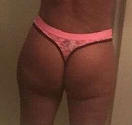 Butt Implants Before & After Patient #8259