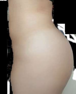 Liposuction Before & After Patient #8837