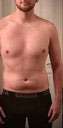 Abdomen Before & After Patient #5875