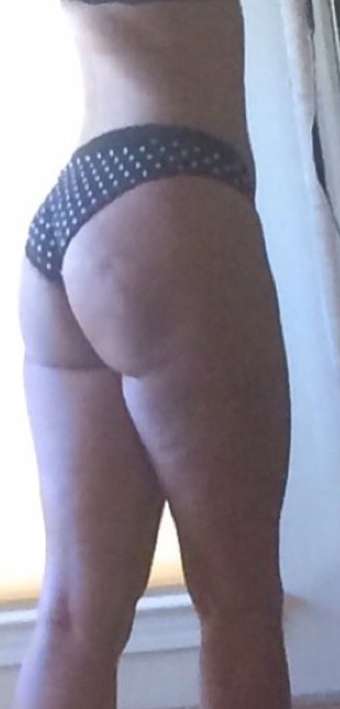 Brazilian Butt Lift Before & After Patient #6527